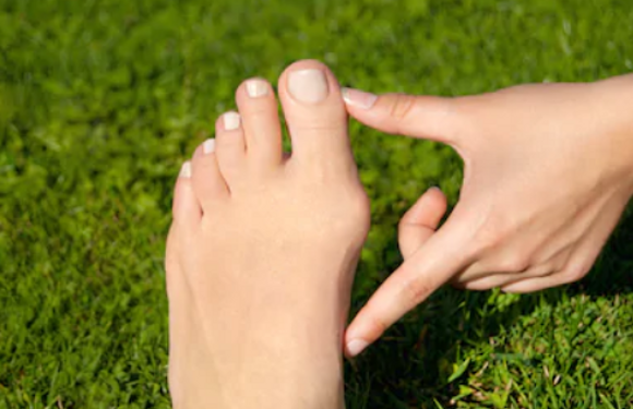 Modzele, kurzajki i odciski na stopach – czym są i jak powstają?
